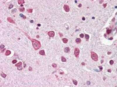 Immunohistochemistry: Cullin-7 Antibody - C-terminus [NBP1-78042]